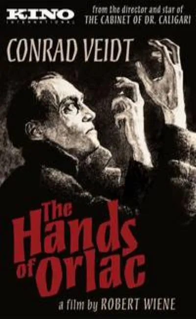 Les mains d'Orlac