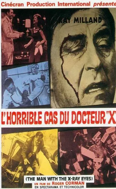 L'horrible cas du docteur X